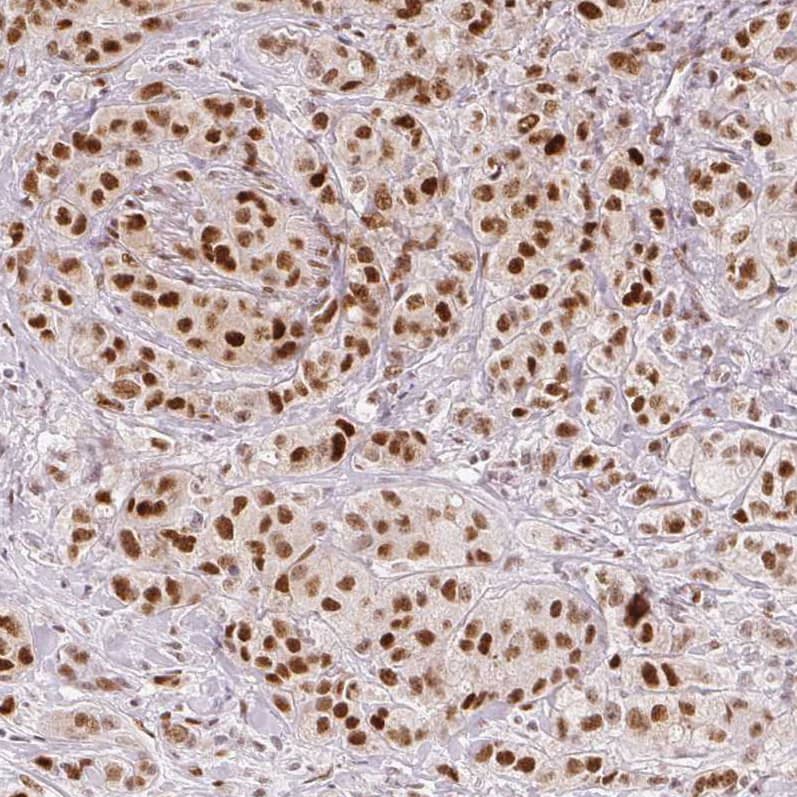 ZNF703 Antibody (CL0654) - Azide and BSA Free Immunohistochemistry-Paraffin: ZNF703 Antibody [NBP3-44019]