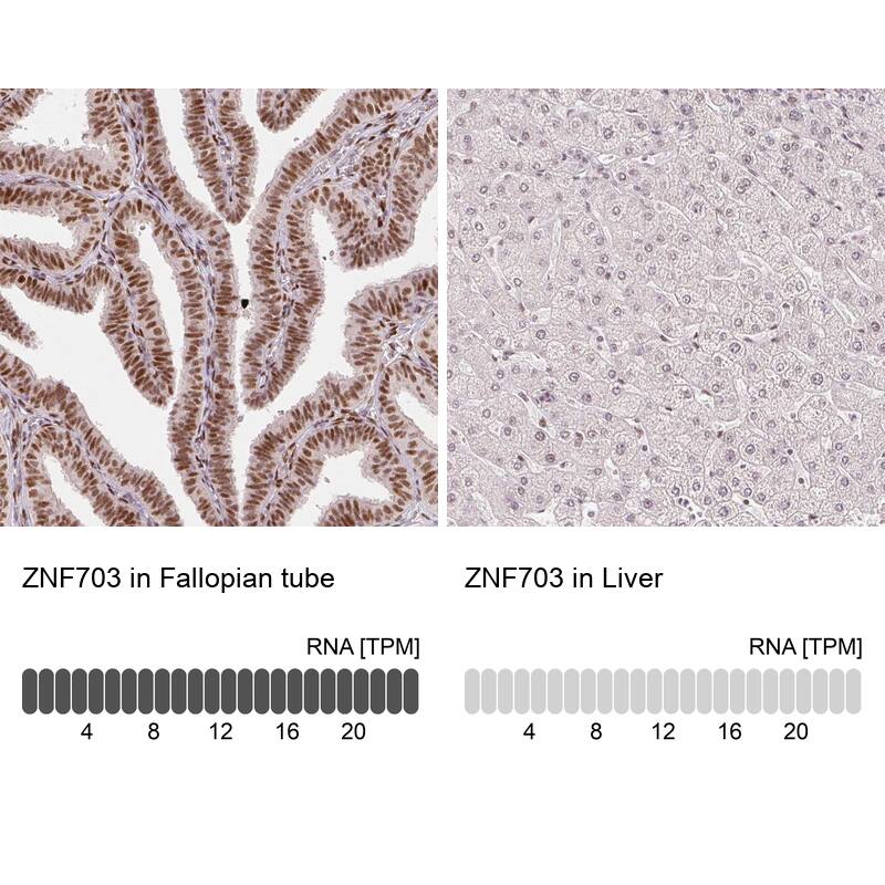 ZNF703 Antibody (CL0654) - Azide and BSA Free Immunohistochemistry-Paraffin: ZNF703 Antibody [NBP3-44019]
