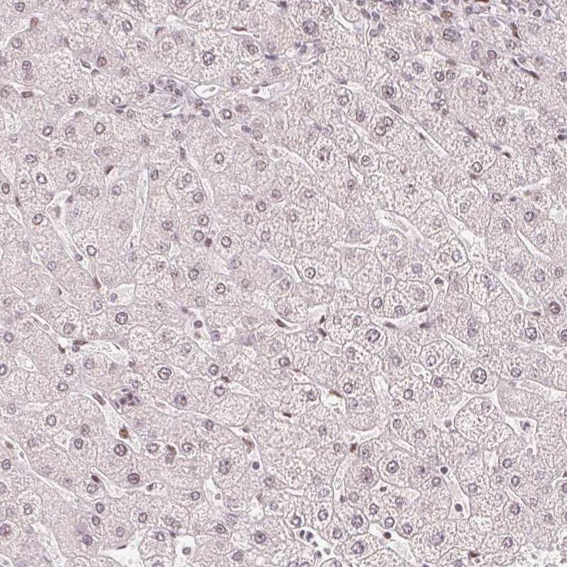 ZNF703 Antibody (CL0654) - Azide and BSA Free Immunohistochemistry-Paraffin: ZNF703 Antibody [NBP3-44019]