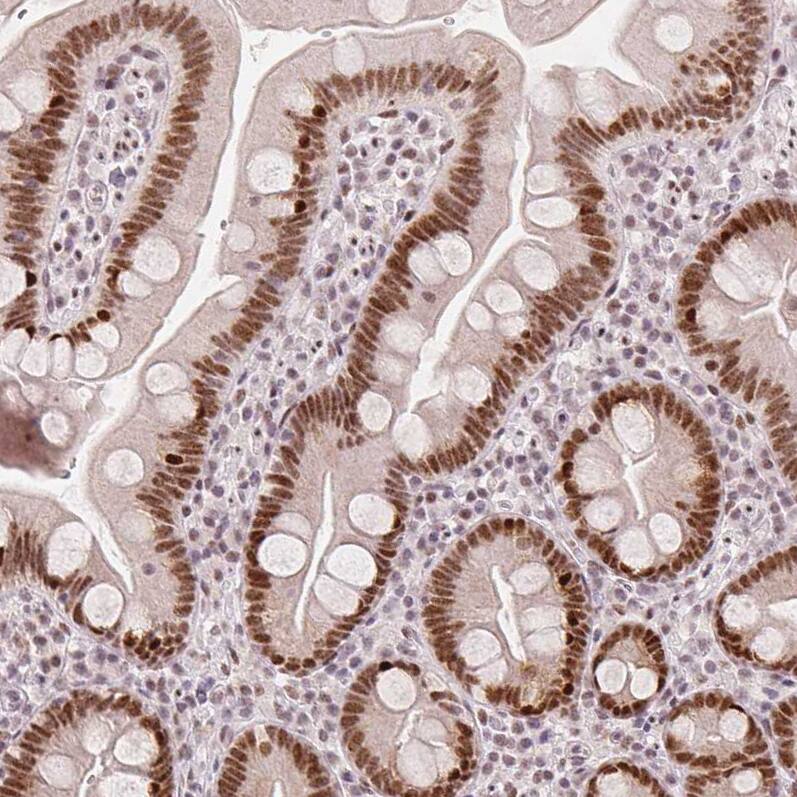 ZNF703 Antibody (CL0654) - Azide and BSA Free Immunohistochemistry-Paraffin: ZNF703 Antibody [NBP3-44019]