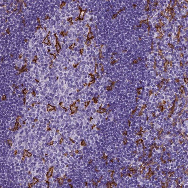 CD11c Antibody (CL1831) - Azide and BSA Free Immunohistochemistry-Paraffin: CD11c Antibody [NBP3-44020]
