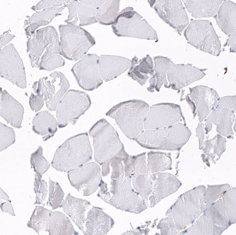 Serpin A3/alpha 1-Antichymotrypsin Antibody (CL10697) - Azide and BSA Free Immunohistochemistry-Paraffin: Serpin A3/alpha 1-Antichymotrypsin Antibody [NBP3-44021]