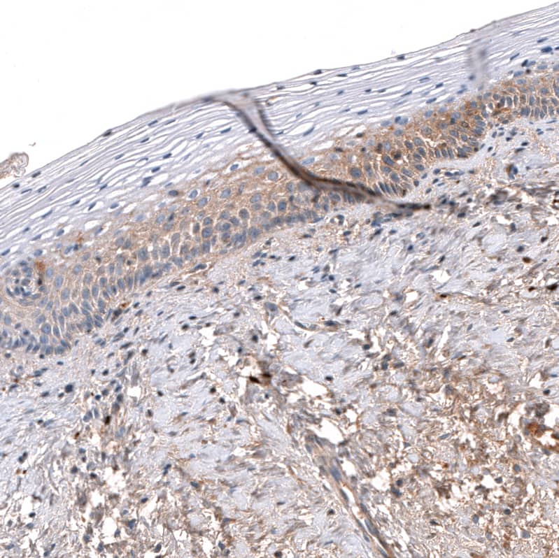 Serpin A3/alpha 1-Antichymotrypsin Antibody (CL10697) - Azide and BSA Free Immunohistochemistry-Paraffin: Serpin A3/alpha 1-Antichymotrypsin Antibody [NBP3-44021]