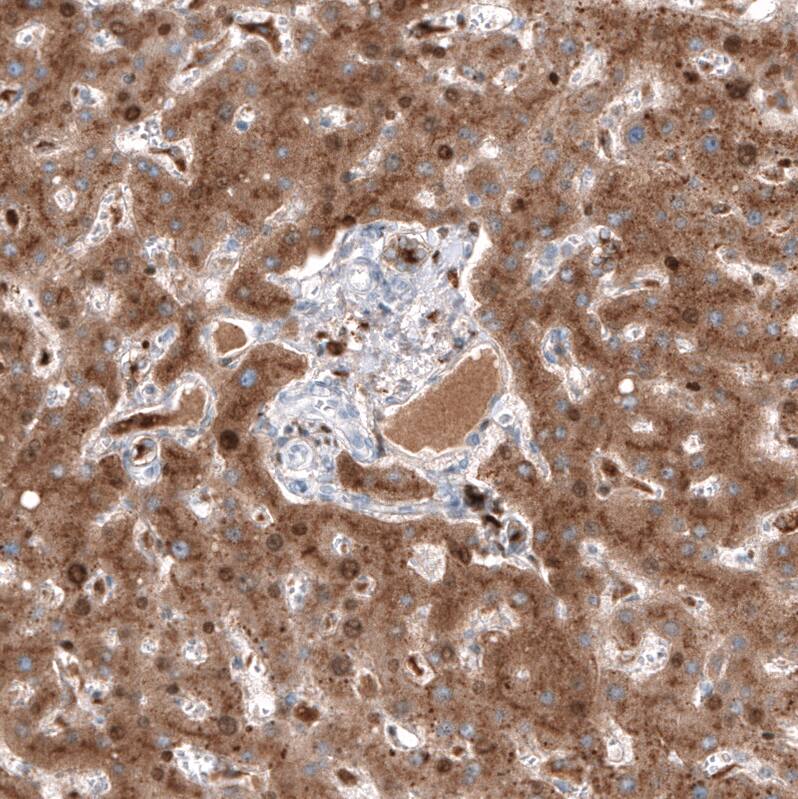 Serpin A3/alpha 1-Antichymotrypsin Antibody (CL10697) - Azide and BSA Free Immunohistochemistry-Paraffin: Serpin A3/alpha 1-Antichymotrypsin Antibody [NBP3-44021]