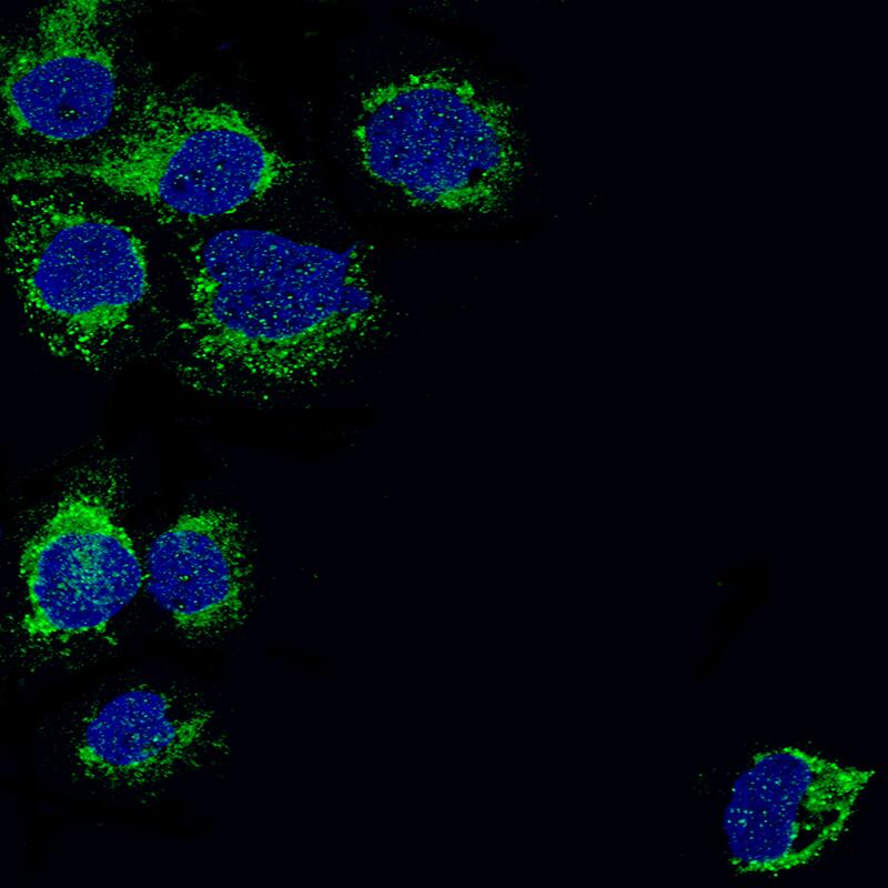 PBR Antibody (CL13359) - Azide and BSA Free Immunocytochemistry/ Immunofluorescence: PBR Antibody [NBP3-44022]