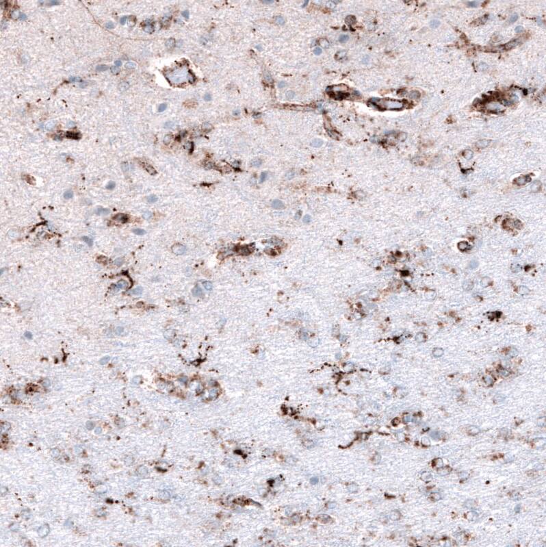 PBR Antibody (CL13359) - Azide and BSA Free Immunohistochemistry-Paraffin: PBR Antibody [NBP3-44022]
