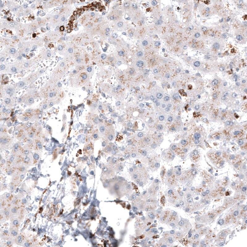 PBR Antibody (CL13359) - Azide and BSA Free Immunohistochemistry-Paraffin: PBR Antibody [NBP3-44022]