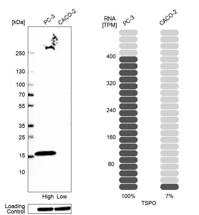 PBR Antibody (CL13359) - Azide and BSA Free Western Blot: PBR Antibody [NBP3-44022]