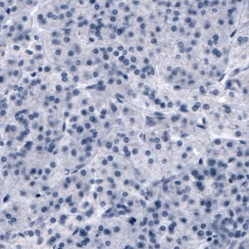 OATP1B3/SLCO1B3/OATP8 Antibody (CL3770) - Azide and BSA Free Immunohistochemistry-Paraffin: OATP1B3/SLCO1B3/OATP8 Antibody [NBP3-44023]
