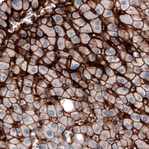 OATP1B3/SLCO1B3/OATP8 Antibody (CL3771) - Azide and BSA Free Immunohistochemistry-Paraffin: OATP1B3/SLCO1B3/OATP8 Antibody [NBP3-44024]