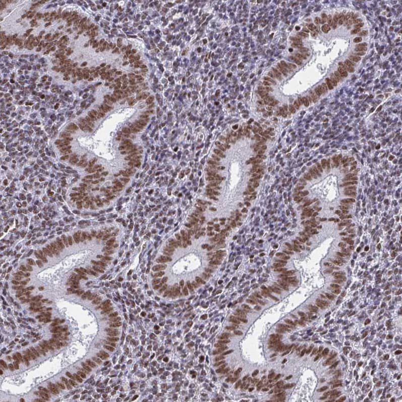 CTCF Antibody (CL0304) - Azide and BSA Free Immunohistochemistry-Paraffin: CTCF Antibody [NBP3-44025]