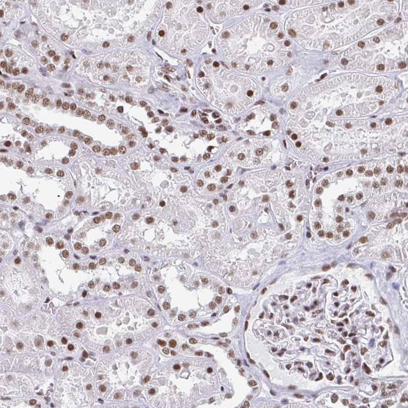 CTCF Antibody (CL0304) - Azide and BSA Free Immunohistochemistry-Paraffin: CTCF Antibody [NBP3-44025]