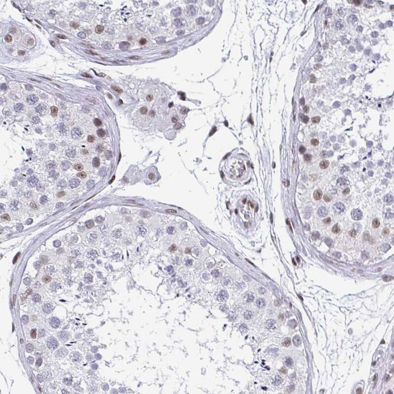 CTCF Antibody (CL0304) - Azide and BSA Free Immunohistochemistry-Paraffin: CTCF Antibody [NBP3-44025]