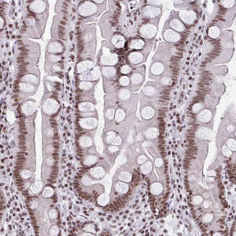 CTCF Antibody (CL0304) - Azide and BSA Free Immunohistochemistry-Paraffin: CTCF Antibody [NBP3-44025]