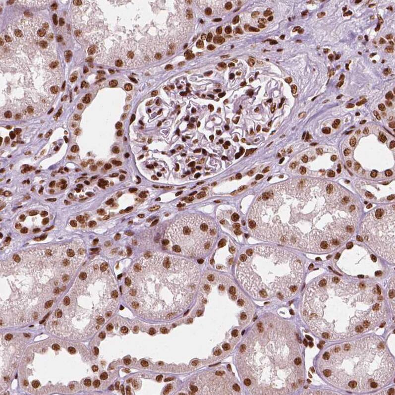 CTCF Antibody (CL0307) - Azide and BSA Free Immunohistochemistry-Paraffin: CTCF Antibody [NBP3-44027]