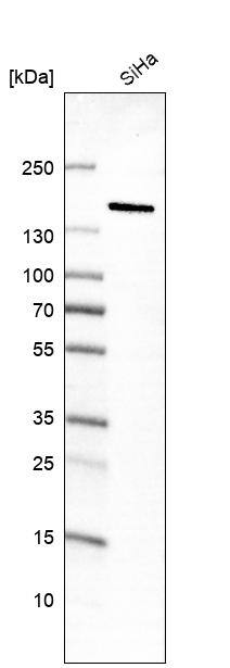 MKL2 Antibody (CL1546) - Azide and BSA Free Western Blot: MKL2 Antibody [NBP3-44028]