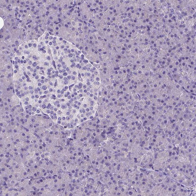CD4 Antibody (CL0395) - Azide and BSA Free Immunohistochemistry-Paraffin: CD4 Antibody [NBP3-44029]