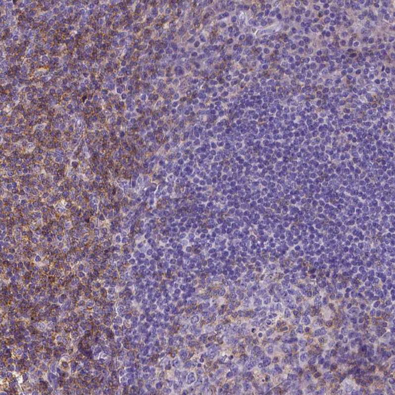 CD4 Antibody (CL0395) - Azide and BSA Free Immunohistochemistry-Paraffin: CD4 Antibody [NBP3-44029]