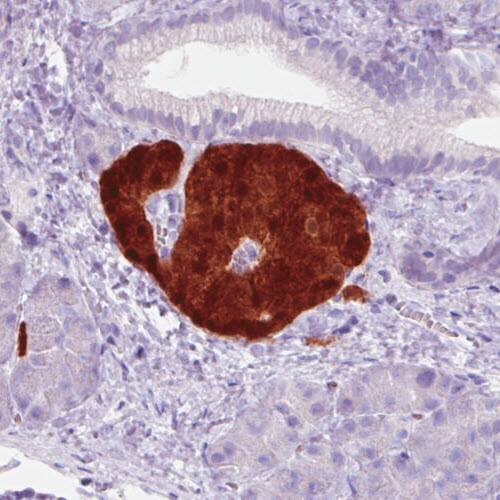 Secretagogin Antibody (CL0271) - Azide and BSA Free Immunohistochemistry-Paraffin: Secretagogin Antibody [NBP3-44030]