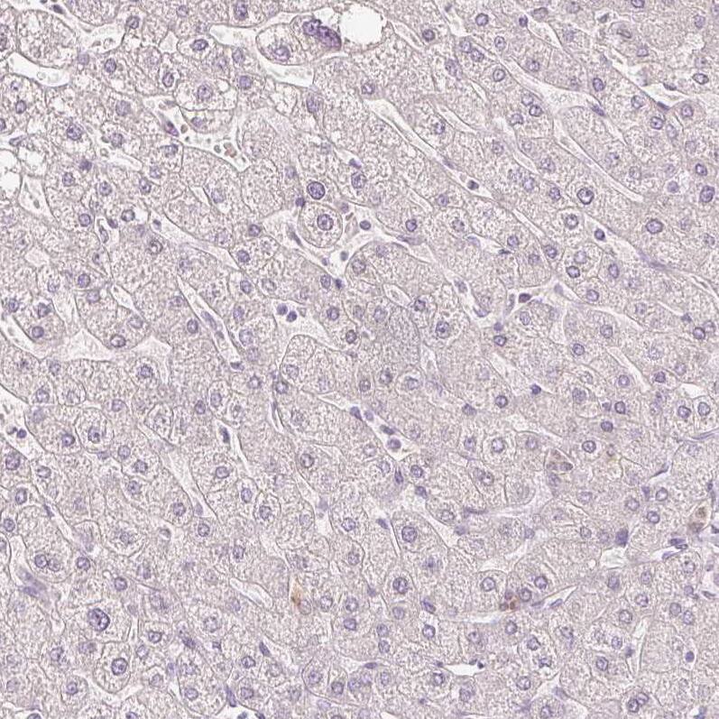Secretagogin Antibody (CL0273) - Azide and BSA Free Immunohistochemistry-Paraffin: Secretagogin Antibody [NBP3-44031]