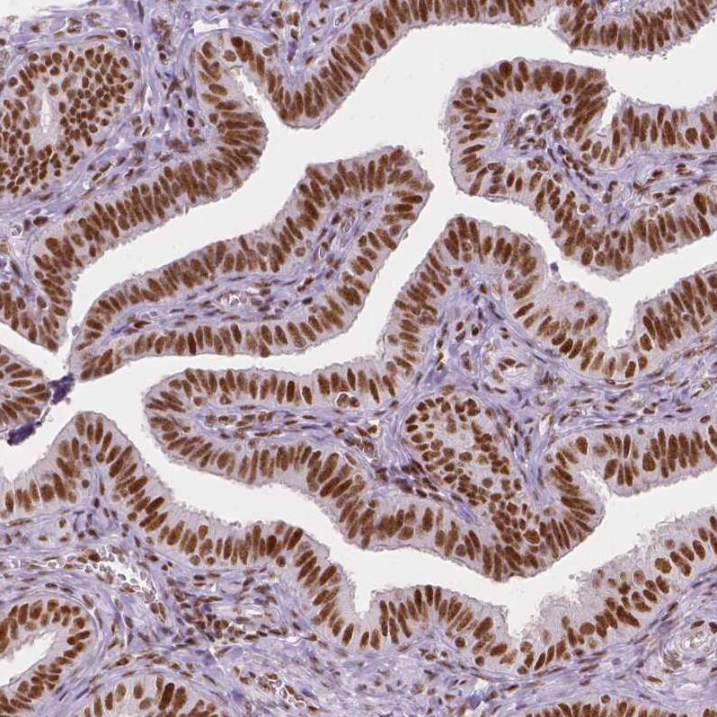 HDAC1 Antibody (CL0510) - Azide and BSA Free Immunohistochemistry-Paraffin: HDAC1 Antibody [NBP3-44032]