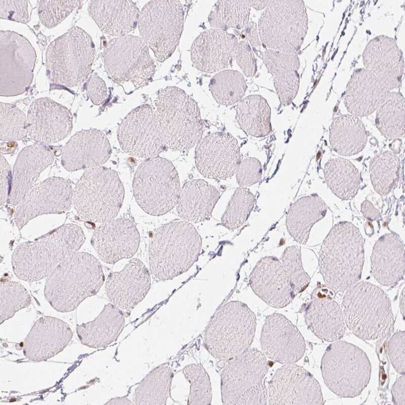HDAC1 Antibody (CL0510) - Azide and BSA Free Immunohistochemistry-Paraffin: HDAC1 Antibody [NBP3-44032]