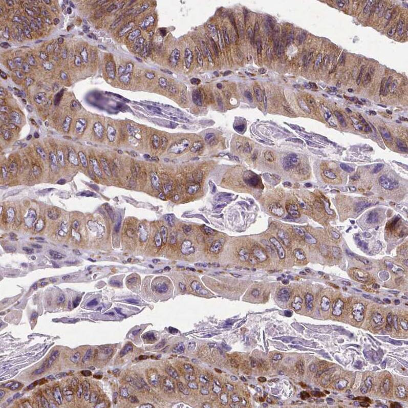 Metadherin Antibody (CL0401) - Azide and BSA Free Immunohistochemistry-Paraffin: Metadherin Antibody [NBP3-44033]