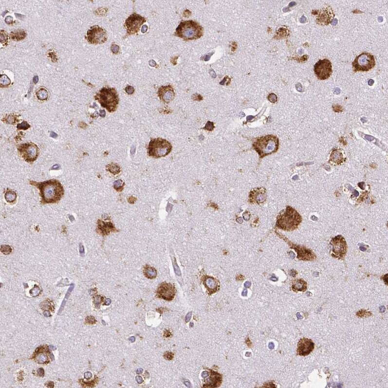 Metadherin Antibody (CL0401) - Azide and BSA Free Immunohistochemistry-Paraffin: Metadherin Antibody [NBP3-44033]