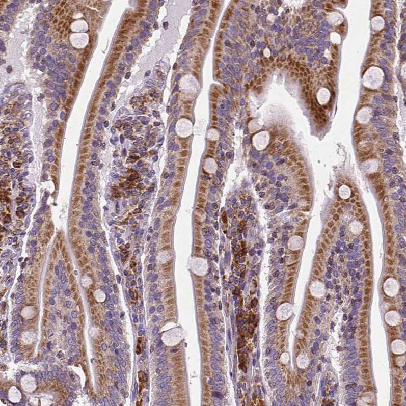 Metadherin Antibody (CL0401) - Azide and BSA Free Immunohistochemistry-Paraffin: Metadherin Antibody [NBP3-44033]
