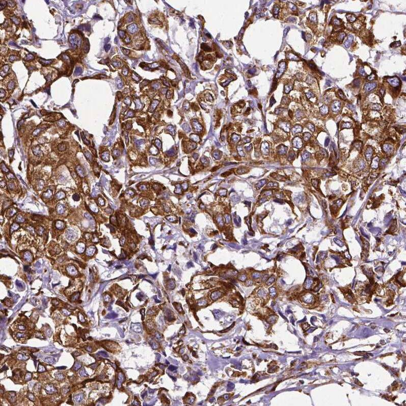 Metadherin Antibody (CL0397) - Azide and BSA Free Immunohistochemistry-Paraffin: Metadherin Antibody [NBP3-44034]