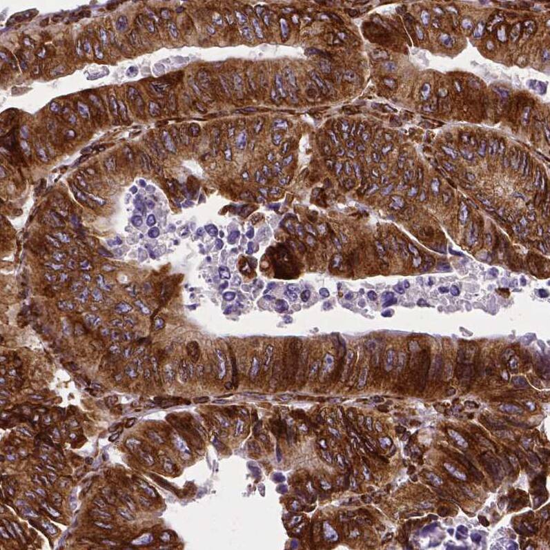 Metadherin Antibody (CL0397) - Azide and BSA Free Immunohistochemistry-Paraffin: Metadherin Antibody [NBP3-44034]