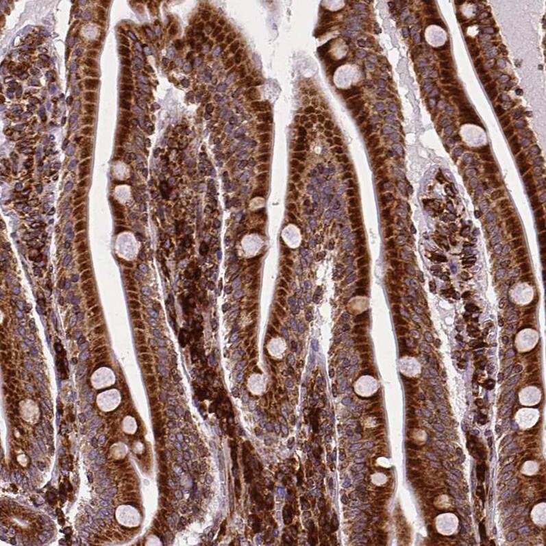 Metadherin Antibody (CL0397) - Azide and BSA Free Immunohistochemistry-Paraffin: Metadherin Antibody [NBP3-44034]