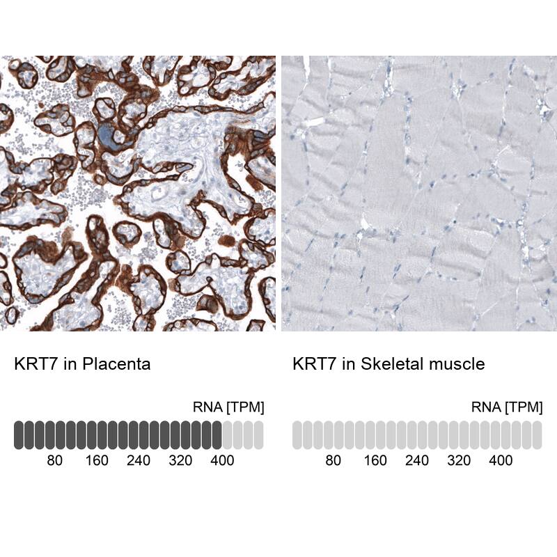 Cytokeratin 7 Antibody (CL8723) - Azide and BSA Free Immunohistochemistry-Paraffin: Cytokeratin 7 Antibody [NBP3-44035]