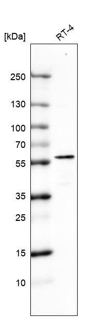 Cytokeratin 7 Antibody (CL8723) - Azide and BSA Free Western Blot: Cytokeratin 7 Antibody [NBP3-44035]