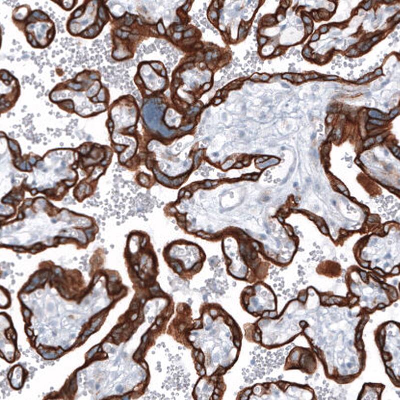 Cytokeratin 7 Antibody (CL8723) - Azide and BSA Free Immunohistochemistry-Paraffin: Cytokeratin 7 Antibody [NBP3-44035]
