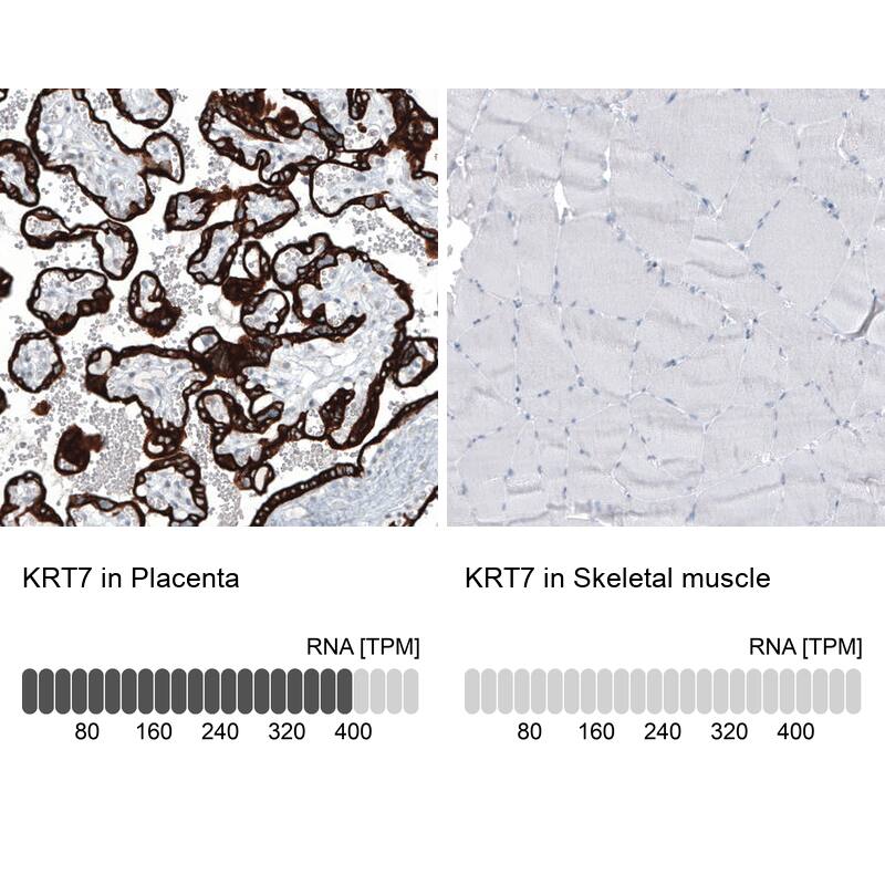 Cytokeratin 7 Antibody (CL8725) - Azide and BSA Free Immunohistochemistry-Paraffin: Cytokeratin 7 Antibody [NBP3-44036]