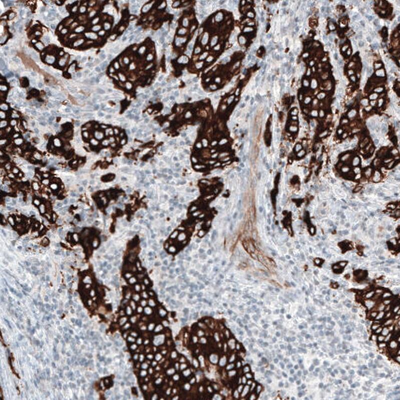 Cytokeratin 7 Antibody (CL8725) - Azide and BSA Free Immunohistochemistry-Paraffin: Cytokeratin 7 Antibody [NBP3-44036]