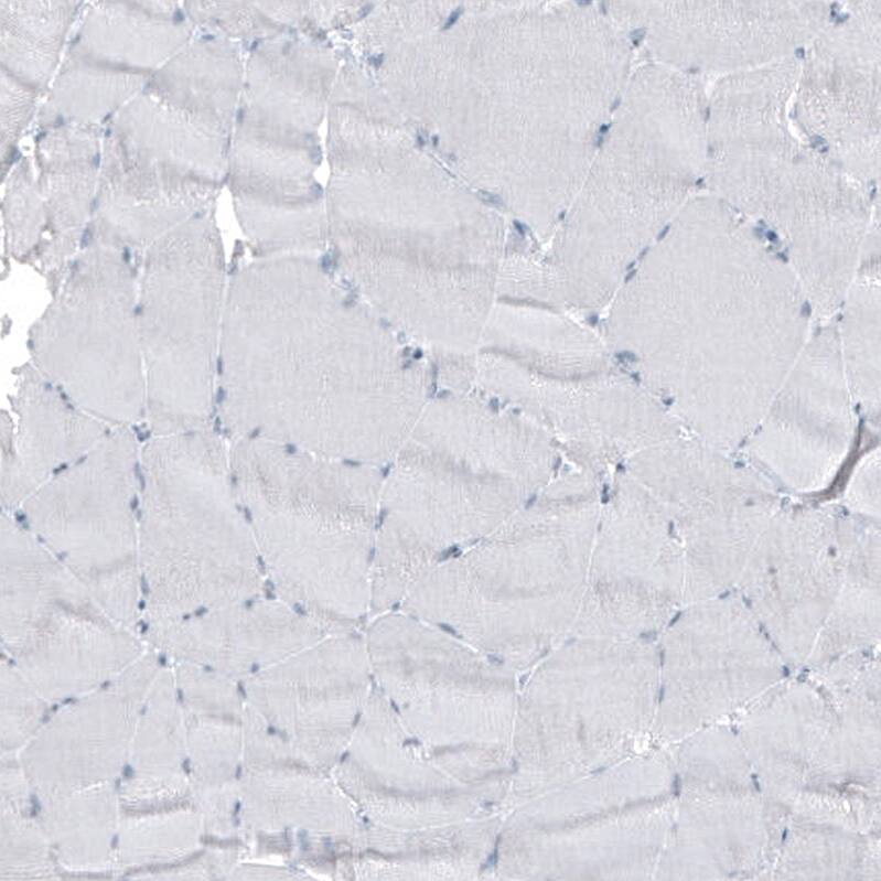Cytokeratin 7 Antibody (CL8725) - Azide and BSA Free Immunohistochemistry-Paraffin: Cytokeratin 7 Antibody [NBP3-44036]
