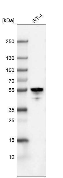 Cytokeratin 7 Antibody (CL8725) - Azide and BSA Free Western Blot: Cytokeratin 7 Antibody [NBP3-44036]