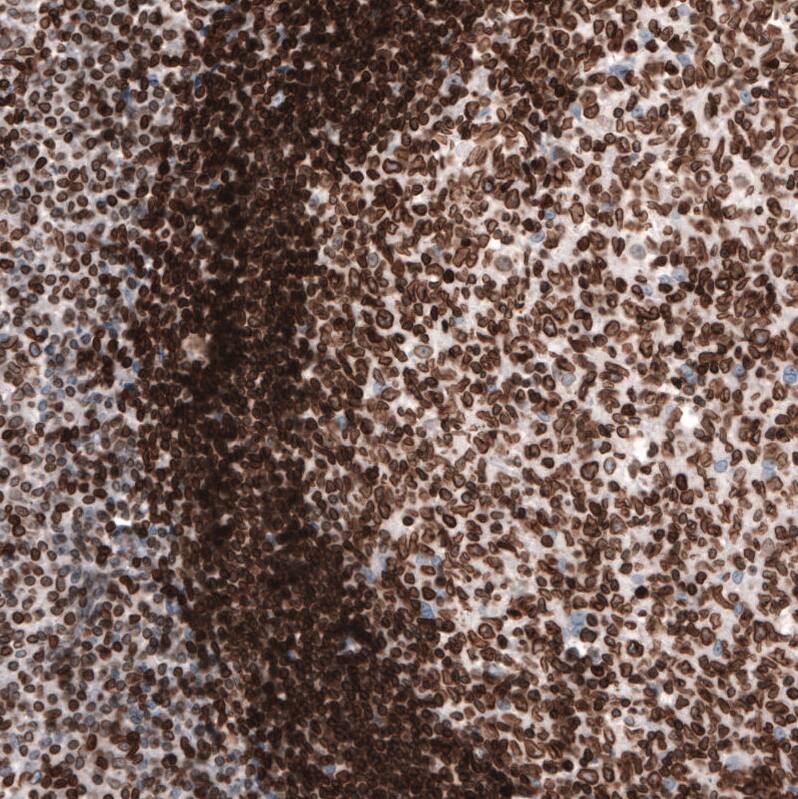 Lamin B1 Antibody (CL3929) - Azide and BSA Free Immunohistochemistry-Paraffin: Lamin B1 Antibody [NBP3-44038]