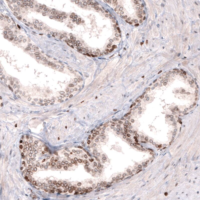 Lamin B1 Antibody (CL3929) - Azide and BSA Free Immunohistochemistry-Paraffin: Lamin B1 Antibody [NBP3-44038]