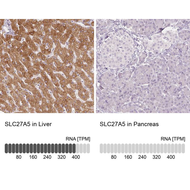 FATP5/SLC27A5 Antibody (CL0216) - Azide and BSA Free Immunohistochemistry-Paraffin: FATP5/SLC27A5 Antibody [NBP3-44040]