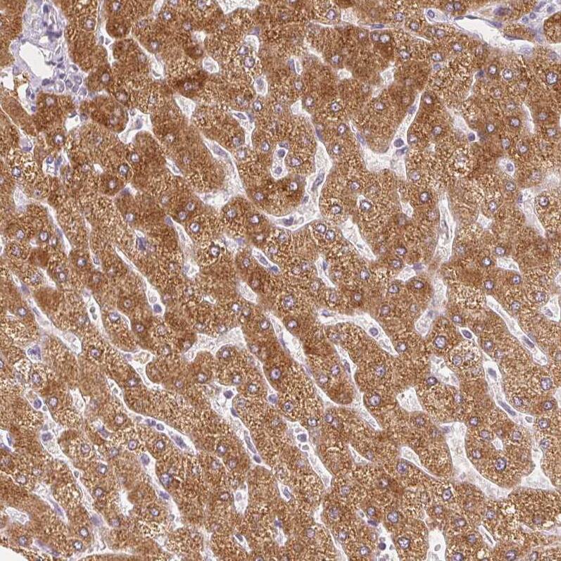 FATP5/SLC27A5 Antibody (CL0216) - Azide and BSA Free Immunohistochemistry-Paraffin: FATP5/SLC27A5 Antibody [NBP3-44040]
