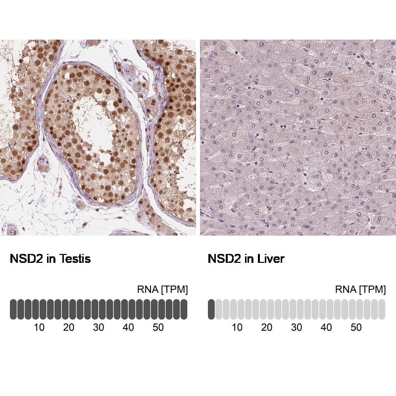 WHSC1 Antibody (CL1057) - Azide and BSA Free Immunohistochemistry-Paraffin: WHSC1 Antibody [NBP3-44041]