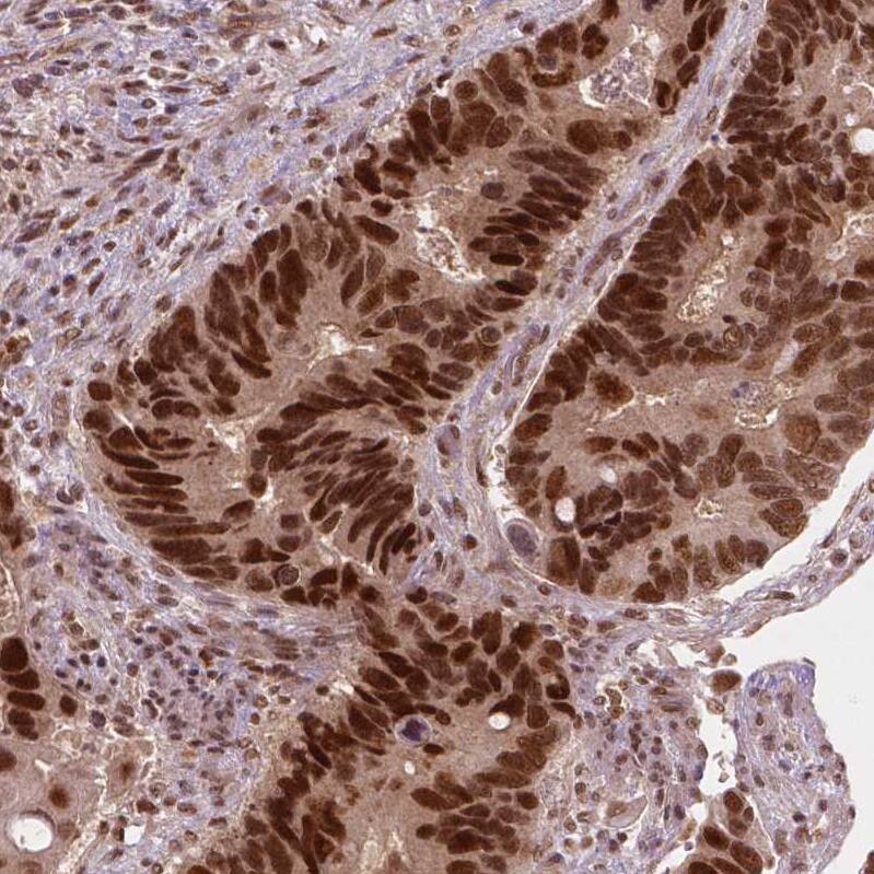 WHSC1 Antibody (CL1057) - Azide and BSA Free Immunohistochemistry-Paraffin: WHSC1 Antibody [NBP3-44041]