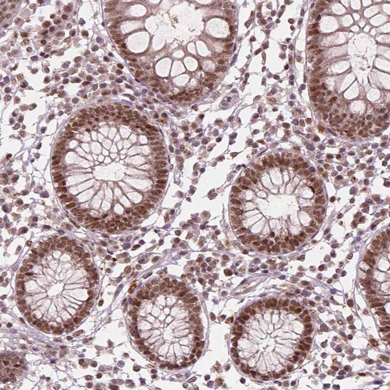 WHSC1 Antibody (CL1057) - Azide and BSA Free Immunohistochemistry-Paraffin: WHSC1 Antibody [NBP3-44041]