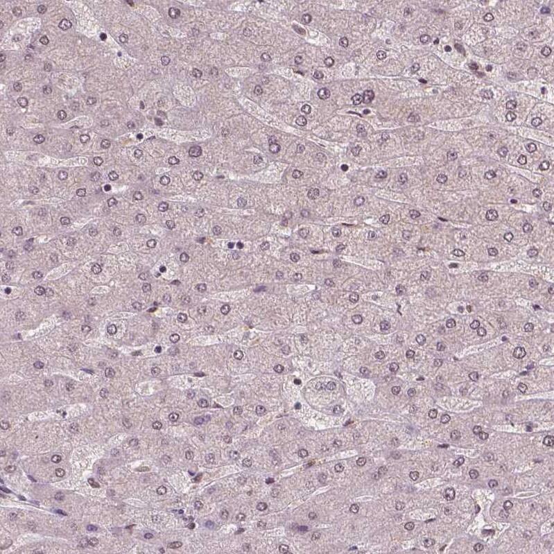 WHSC1 Antibody (CL1057) - Azide and BSA Free Immunohistochemistry-Paraffin: WHSC1 Antibody [NBP3-44041]