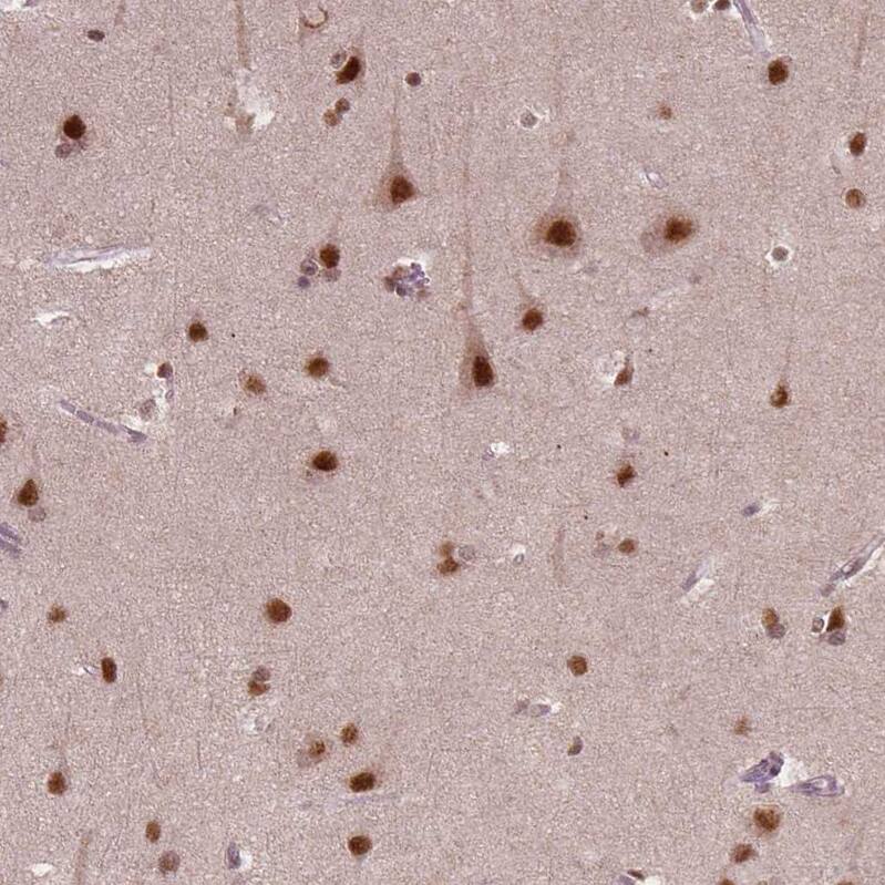 WHSC1 Antibody (CL1057) - Azide and BSA Free Immunohistochemistry-Paraffin: WHSC1 Antibody [NBP3-44041]