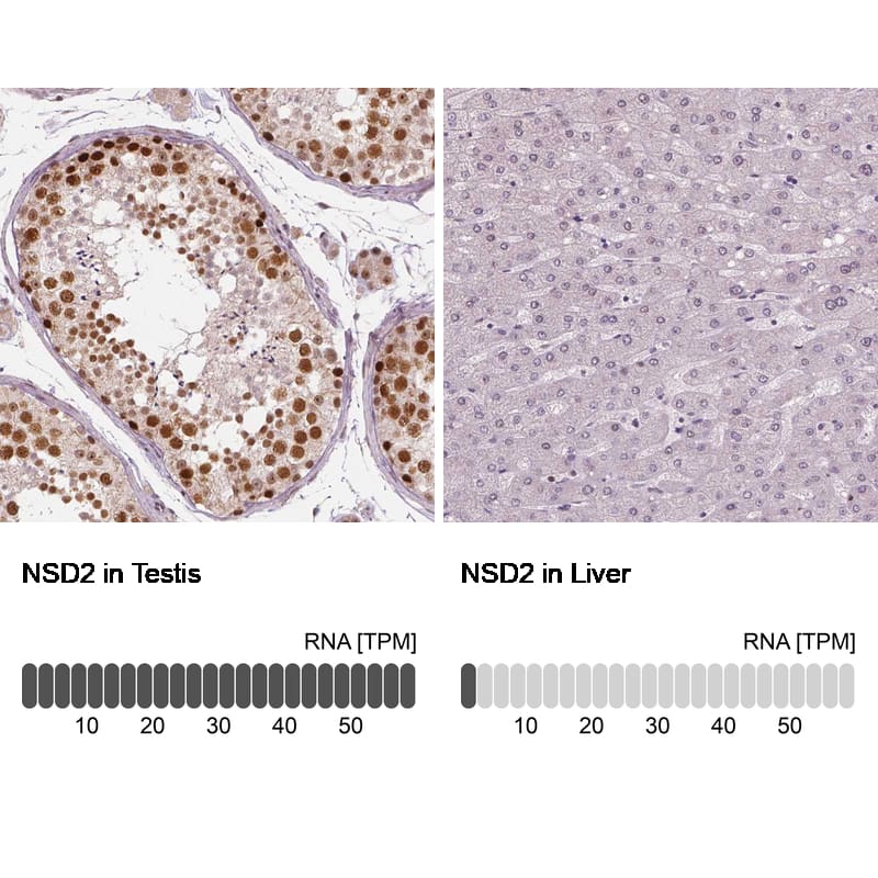 WHSC1 Antibody (CL1063) - Azide and BSA Free Immunohistochemistry-Paraffin: WHSC1 Antibody [NBP3-44042]