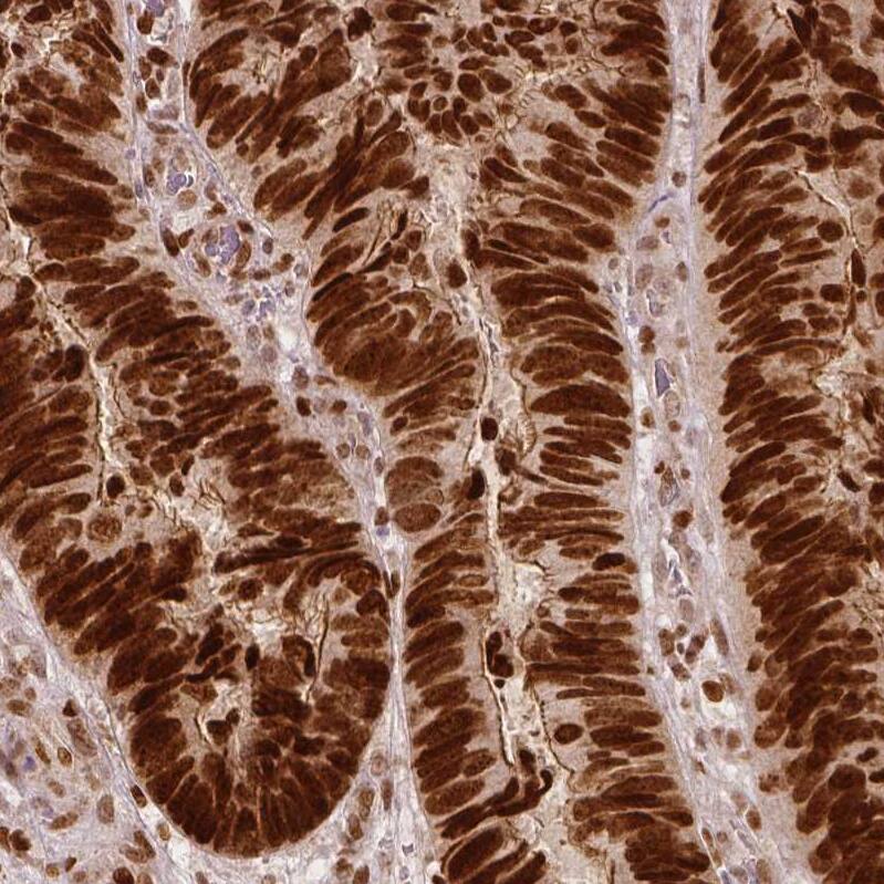 WHSC1 Antibody (CL1063) - Azide and BSA Free Immunohistochemistry-Paraffin: WHSC1 Antibody [NBP3-44042]